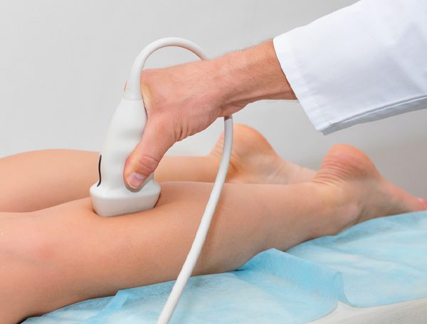 Como é feito o exame Duplex Scan