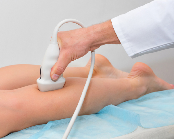 Como é feito o exame Duplex Scan